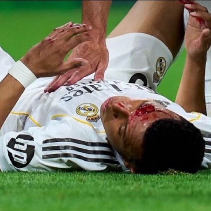 kaiyun-记者：24个摄像头仅1个拍到姆巴佩流血，VAR裁判当时不知道情况